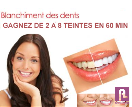 Smile design esthétique dentaire cabinet dr bendisari taleb d Image